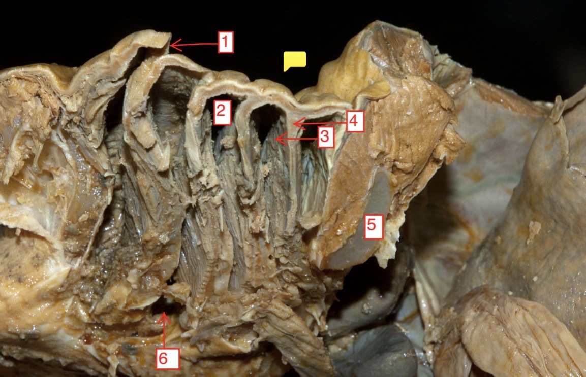 <p>female spiny dogfish section through gill arches- (6)</p>