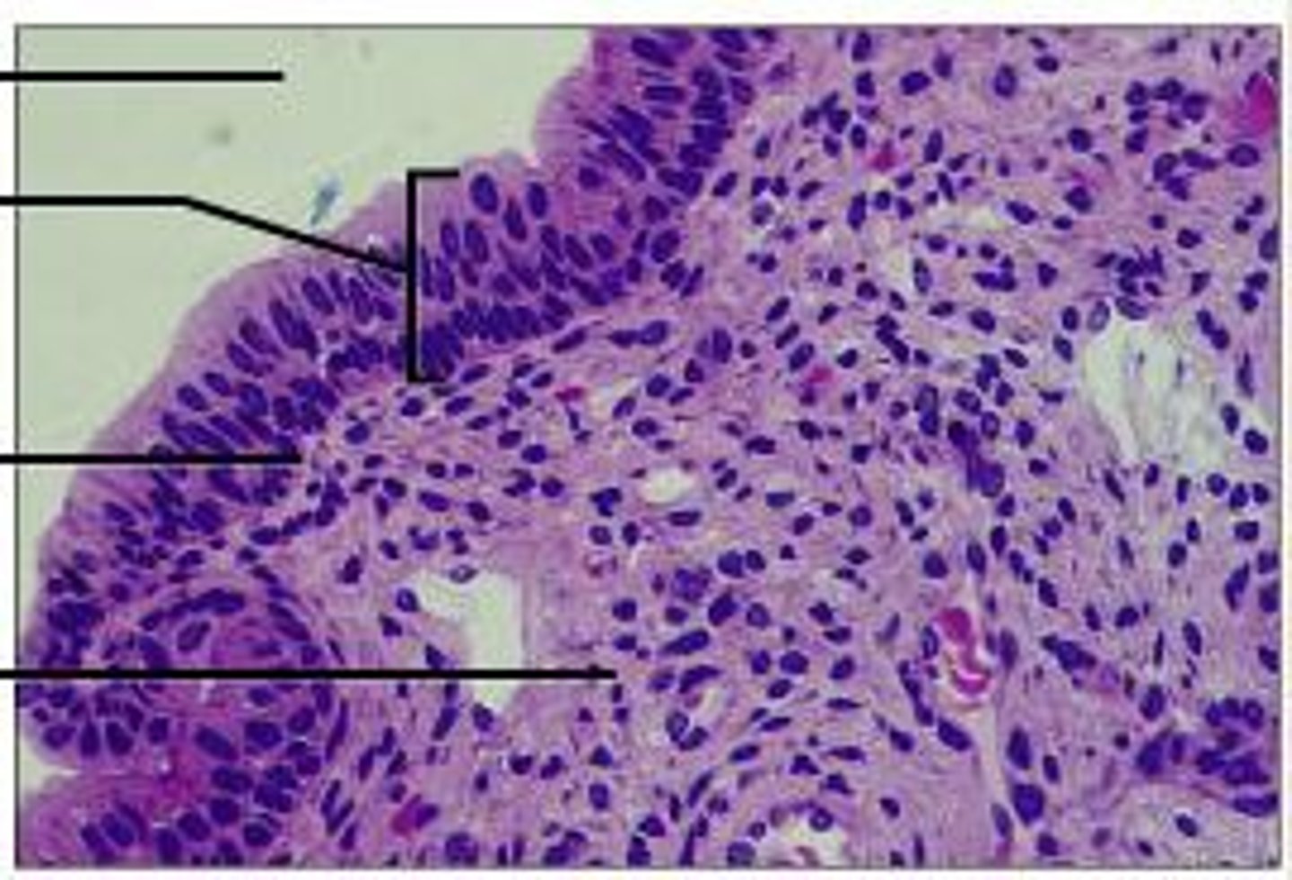 <p>Function: absorption, secretion</p><p>Location: salivary glands, pancreas</p>
