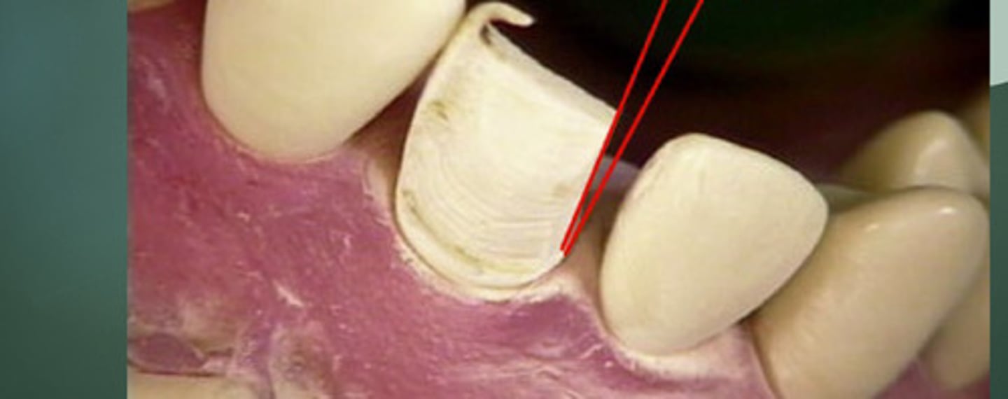 <p>There should be a ___ taper</p>