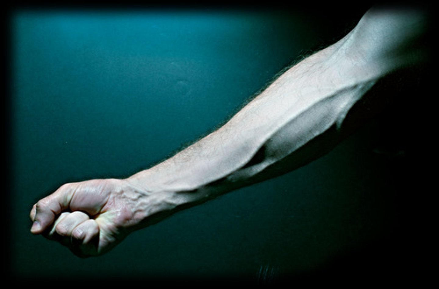 <p>arm</p>