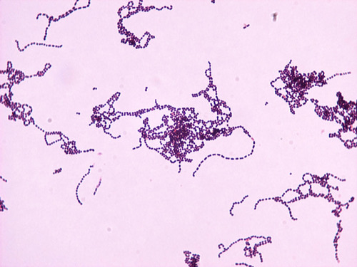 - infections of skin and blood
- ex: pharyngitis, pneumonia, scarlet & rheumatic fever
- carriage = 10-20%
- gram POSITIVE cocci in CHAINS
- catalase = negative
- produces exotoxins, exoenzymes, superantigens
- not very resistant; can still use beta-lactams