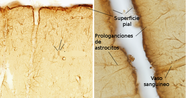 <p>Que tipo de celula es?</p>