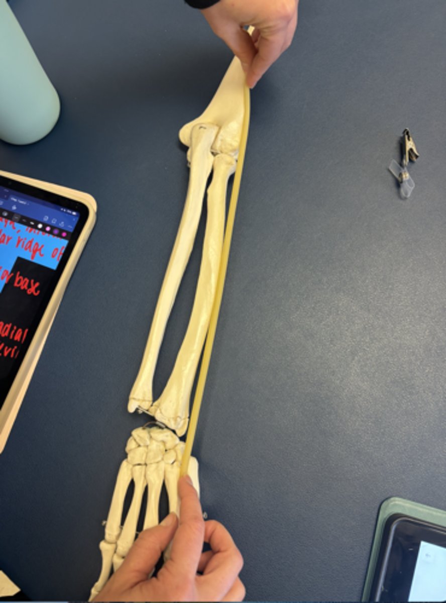 <p>What is this muscle?</p>