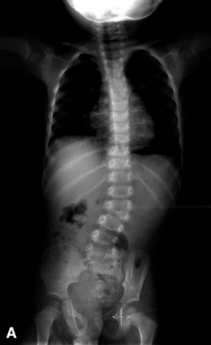 <p>Describe findings</p>