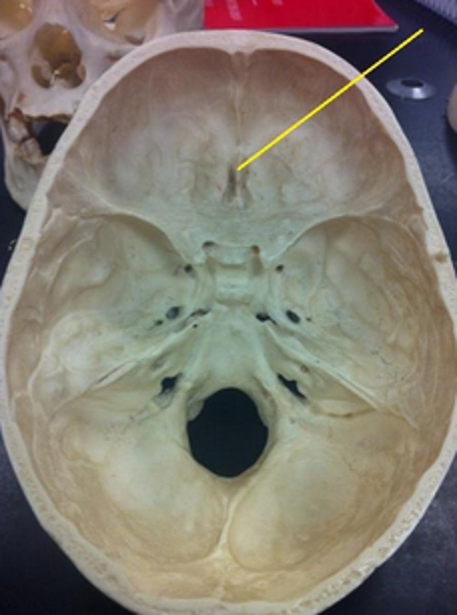 knowt flashcard image