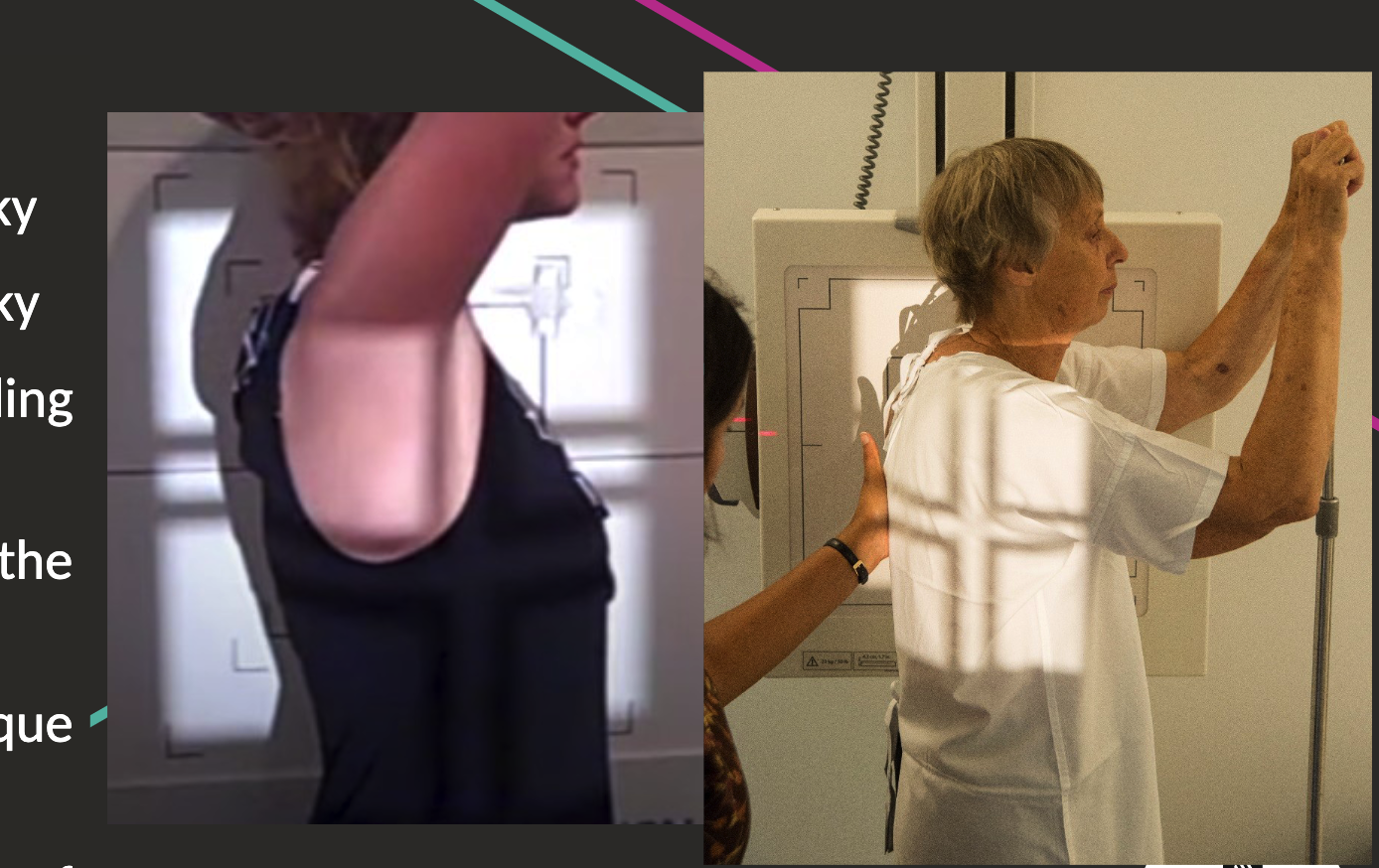 <ul><li><p>Patient’s left side against bucky.</p></li><li><p>Shoulder in contact with bucky, hands on head or holding handlebar.</p></li><li><p>Centre T7 on mid-auxillary line (base of shoulder blade).</p></li></ul><p></p>