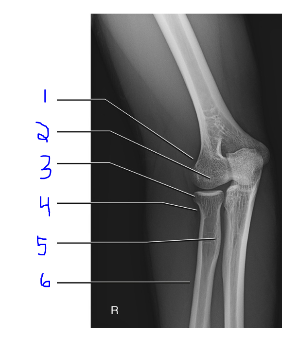 <p>Label</p>