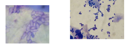 <p>Use of methyl bue and gram stain to see yeast cells </p>
