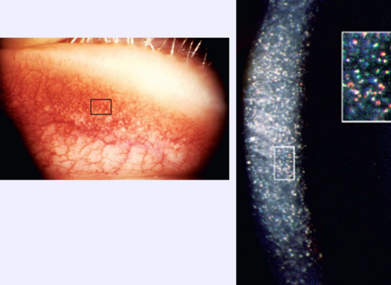 <p>What condition is this?</p>