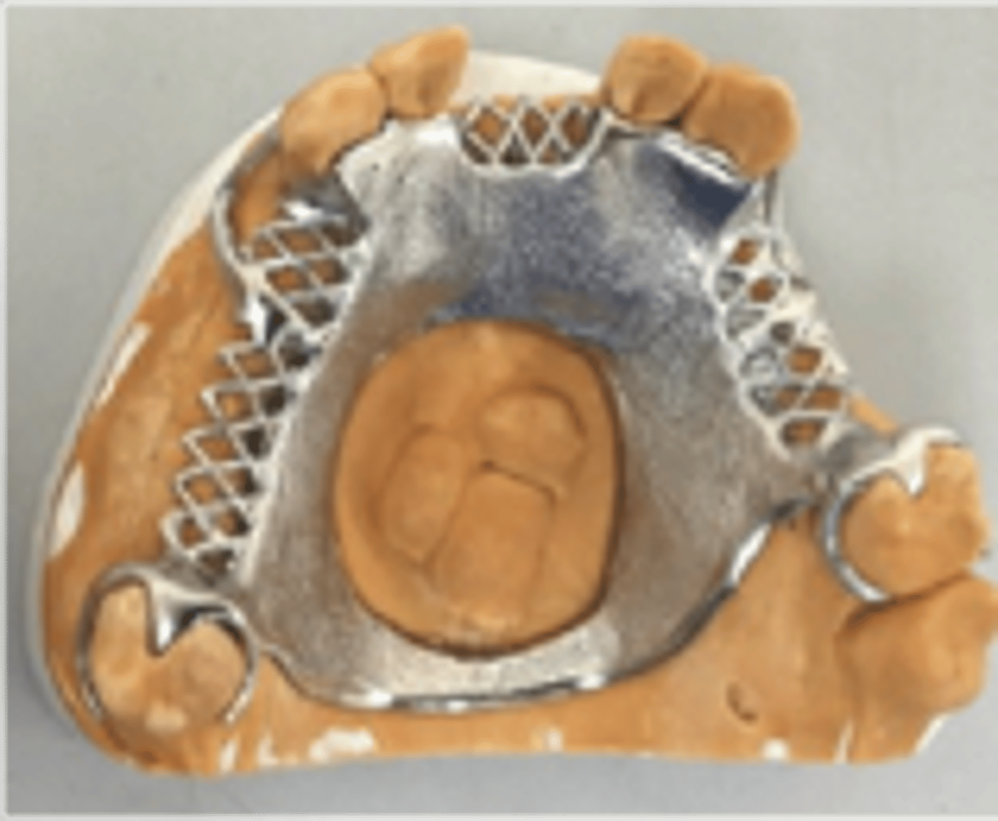 <p>Applegate’s Rules:</p><p>Rule 8. No modification areas can be included in _______ arches (due to the most posterior edentulous area determining the Kennedy class)</p>