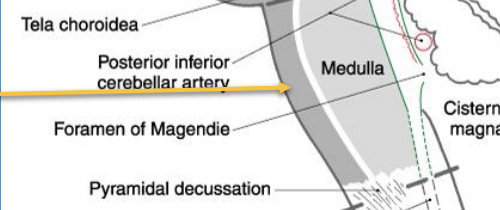 <p>midsagittal view </p>