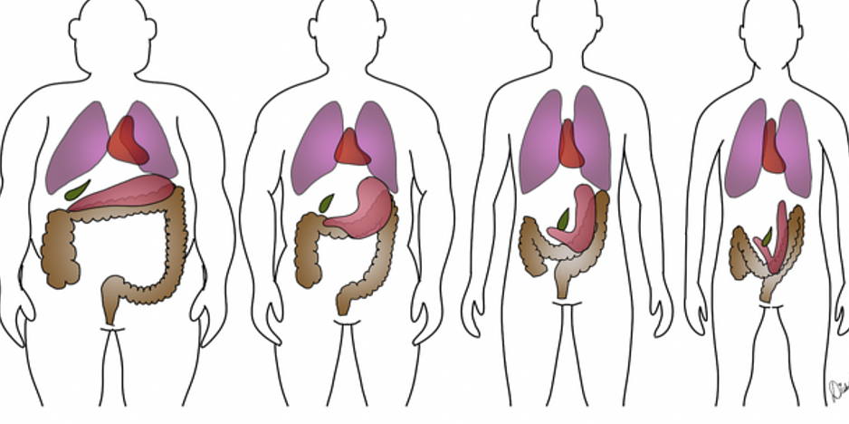 <p>4 types of body habitus</p>