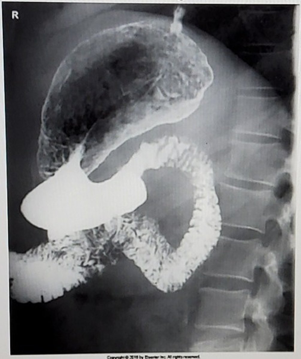 <p>What position is this image?</p><p>A. RAO</p><p>B. AP</p><p>C. RPO</p><p>D. Right lateral</p>