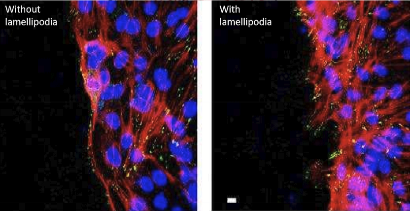 <p>Focal adhesion attached to actin filaments </p>