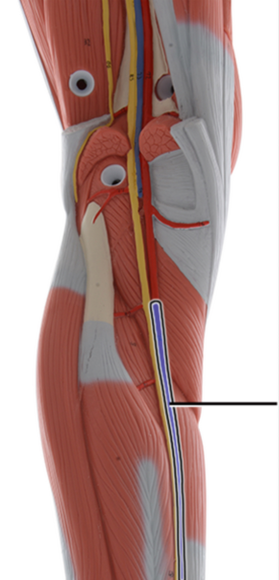 <p>Name this artery.</p>