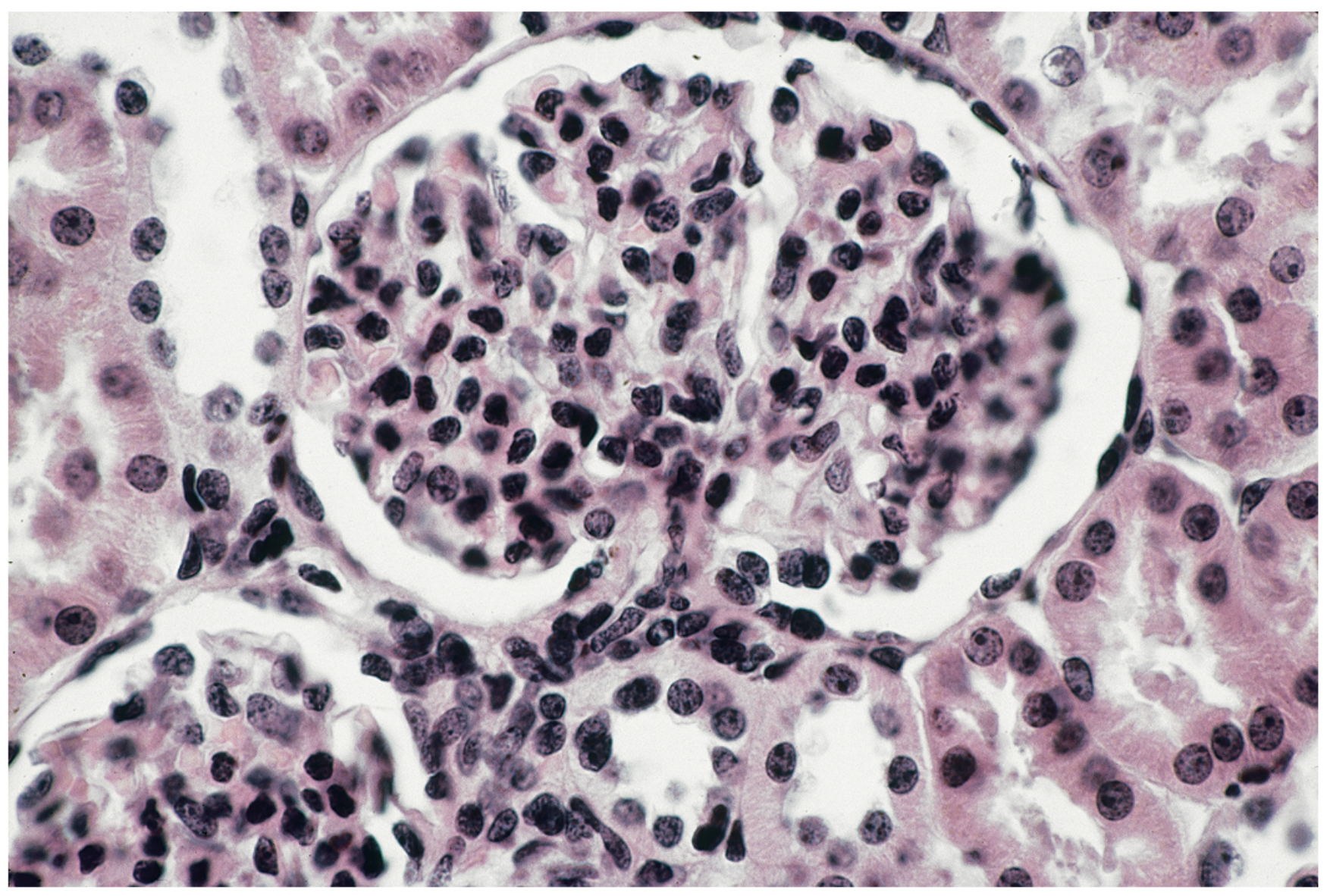 <p>Simple squamous epithelium.</p>