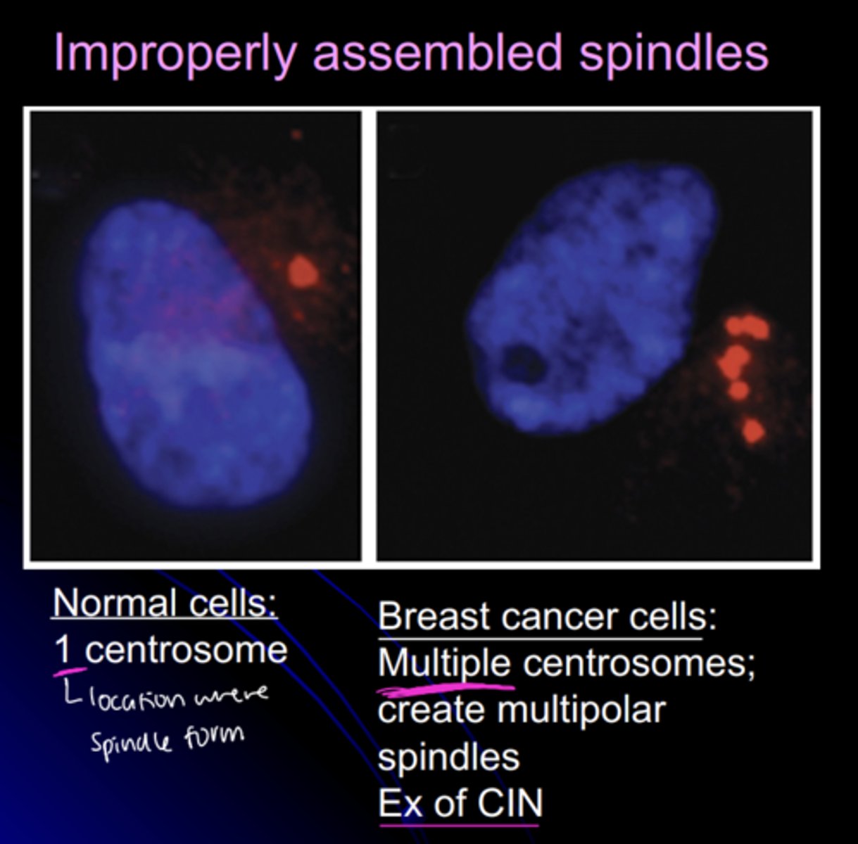 <p>normal cells: </p><p>- 1 centrosome</p><p>cancer cells:</p><p>- multiple centrosomes</p><p>- multipolar spindles</p><p>- example of CIN</p>