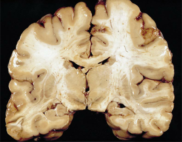 <p>which plane is shown here?</p>