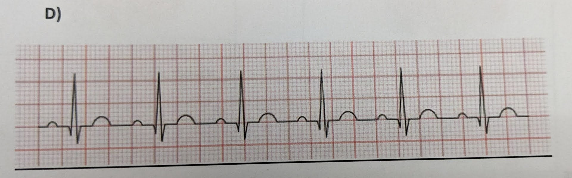 <p>identify the ECG abnormalities (if any)</p>