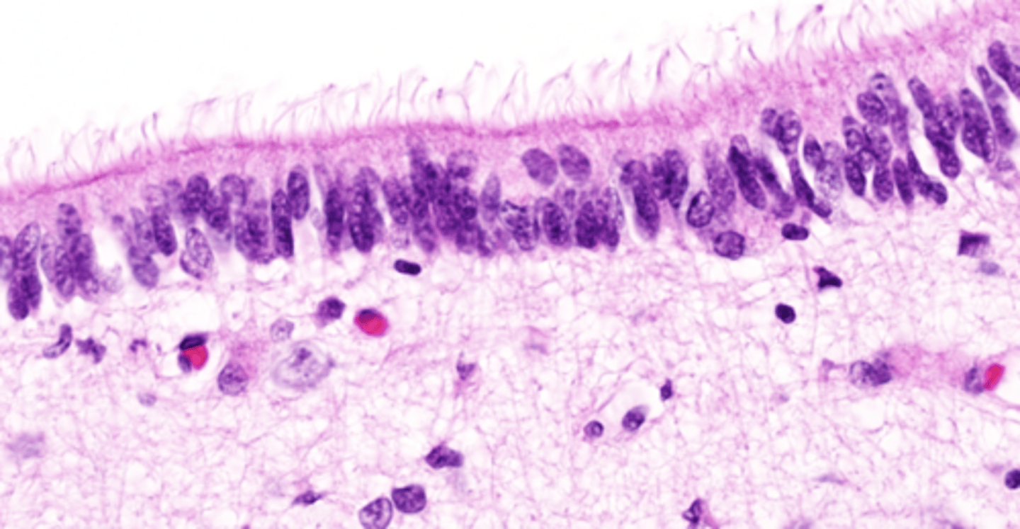 <p>Shock absorber secreted by specialized cells that line the ventricles.</p>