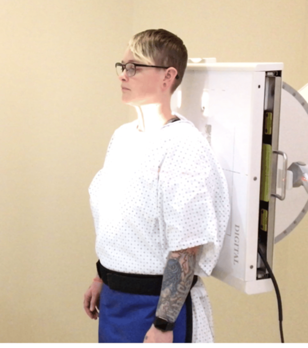<p>Pt Placement: standing</p><p>Measure: over shoulder sternum to spine</p><p>Collimation: 7x17</p><p>CR Placement: T6, top of film 1.5" above sternal notch</p><p>Tube tilt: none</p><p>SID: 40"</p><p>Breathing: Inhale and hold</p>