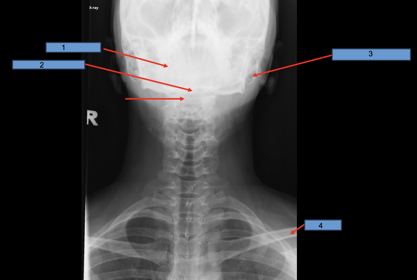 <p>Identify 1</p>