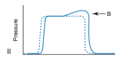<p>What does this indicate?</p>