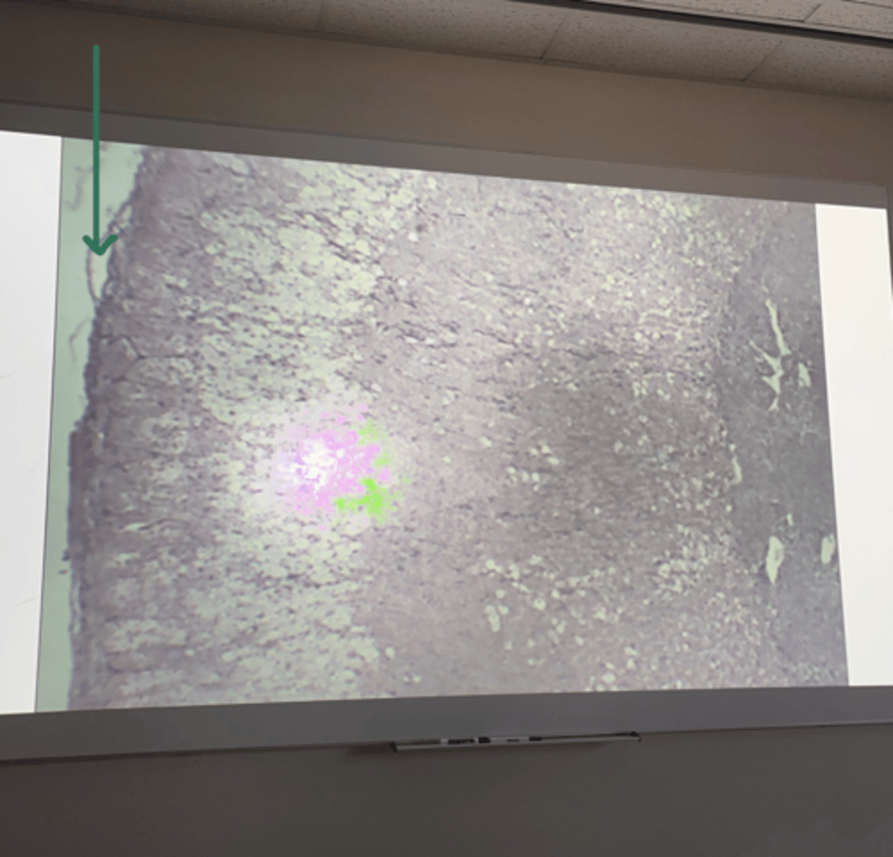 <p>gland and structure</p>