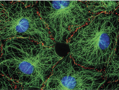 <p>use portions of protein strands to move/ “crawl” &amp; change shape</p>