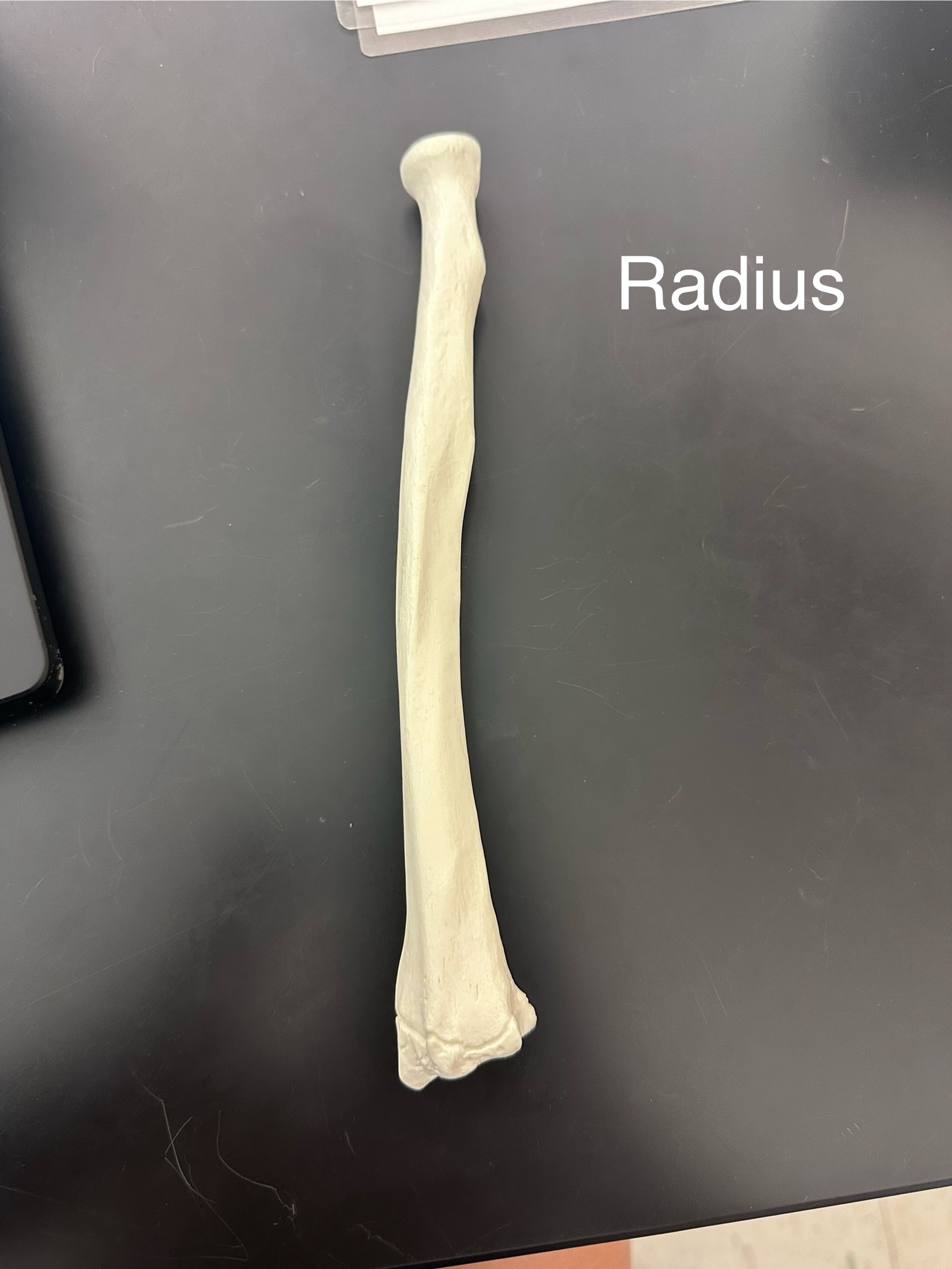 <p>Radius</p>
