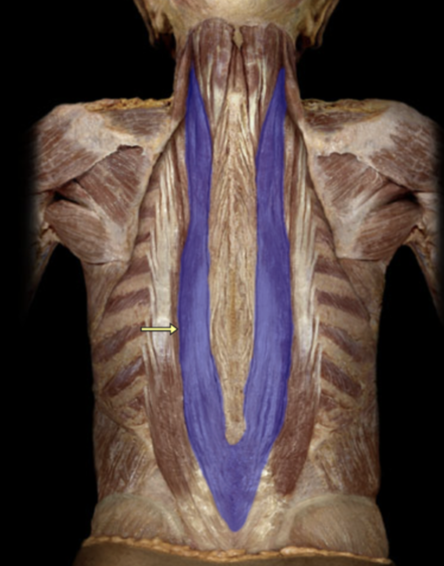 <p>Longissimus M.</p>