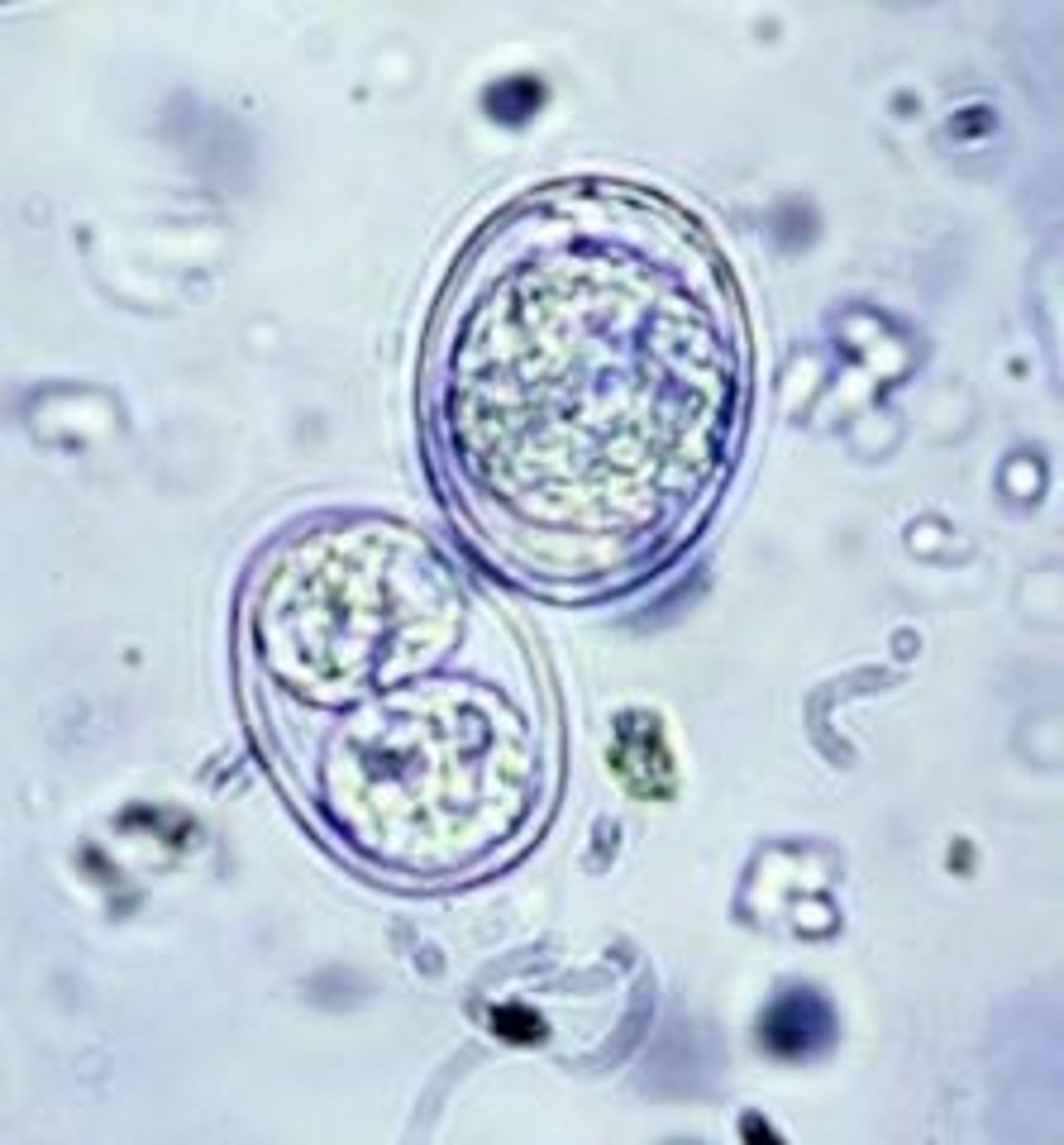 <p>is a subclass of Coccidia. it is a prasitic protozoa that infects the GI tract of the obligate host and the tissues of the intermediate hosts body. cats are the definitive host for the unsporulated stages, rodents and birds are the ideal inntermediate host. Most mammals including humans are incidental or dead-end hosts. cats are uneffected by the parasite. in other hosts they migrate to tissues in the body causing an infection. the infection in a pregnant human can cause harm to a fetus.</p>