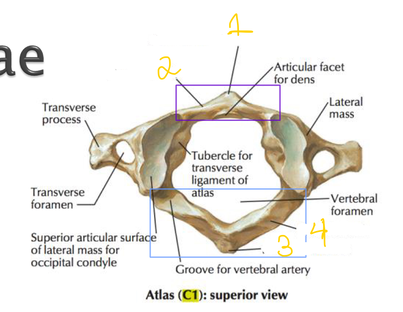 What part of the atlas vertebrae is indicated by number 1 in the image?