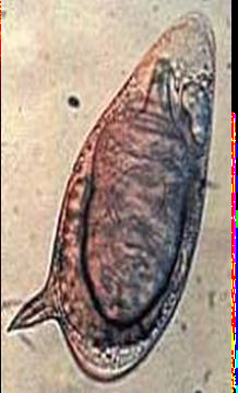 <p><strong>Identify the parasite (Genus, species, and stage).</strong></p><p><strong>Mention two characteristic features of this stage.</strong></p><p><strong>Mention the direct methods used for diagnosing the neurological form of this disease.</strong></p><p><strong>Specify CSF characteristics in case of neurological affection.</strong></p>