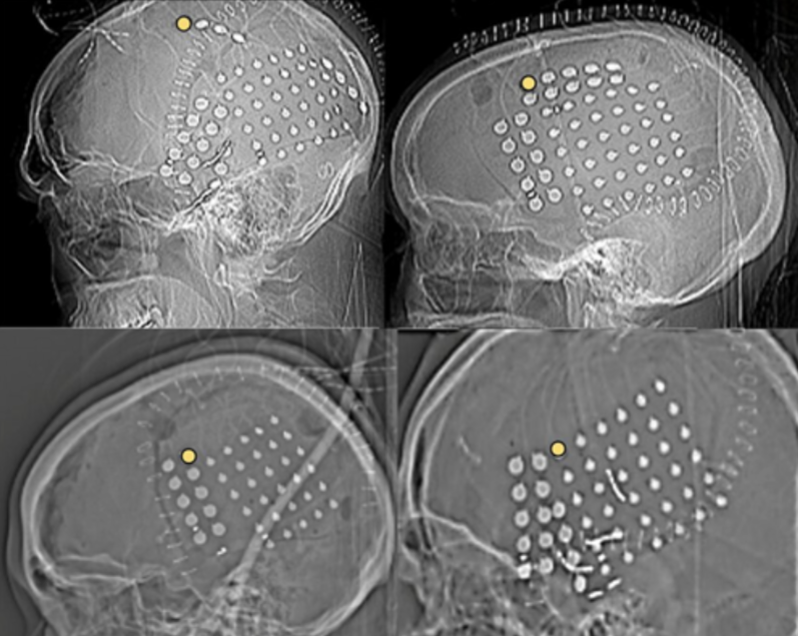 <p>What method of studying the brain is this?&nbsp;</p>