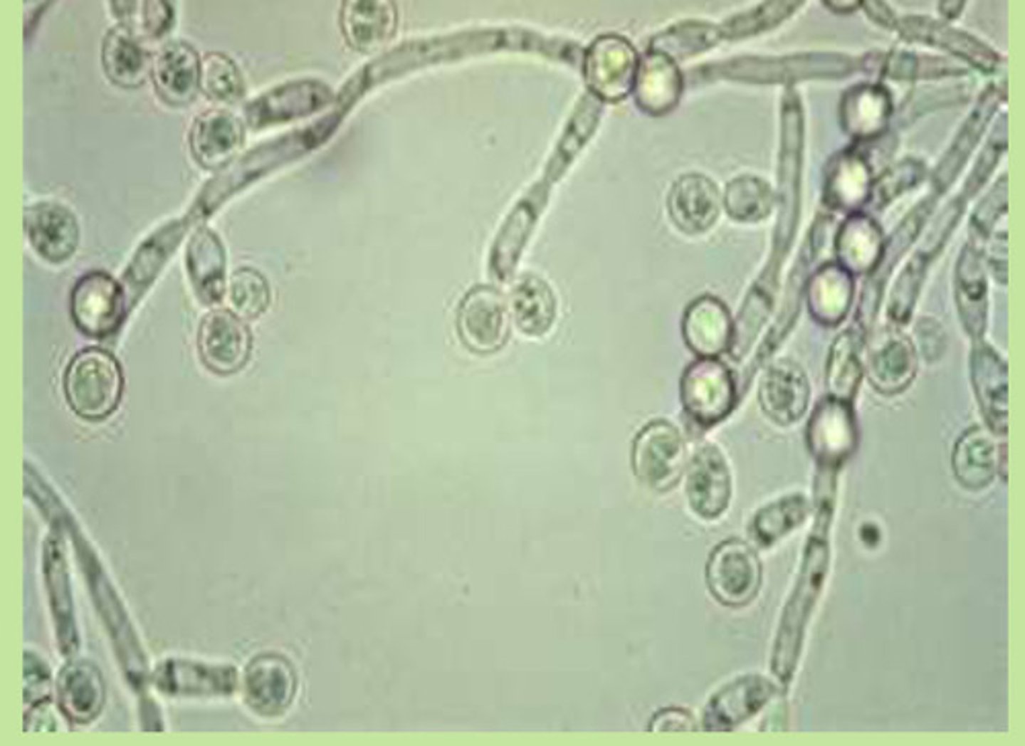 <p>Appears as gram positive, large, budding</p>