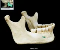 <p>mandible</p>