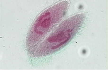 <p><strong><em>Paramecium spp. — </em></strong></p><p>Identify the type of reproduction.</p>