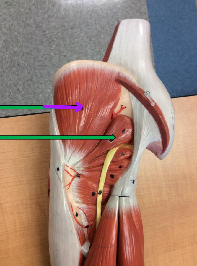 <p>Identify this muscle?</p>