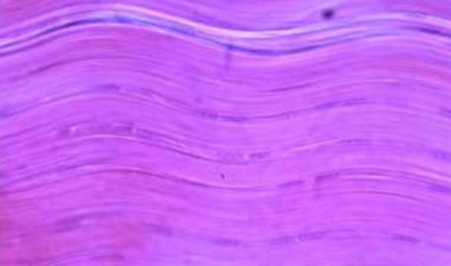 <p>Dense Regular (dense connective tissue)</p>