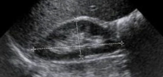 <p>What is this image showing?</p>