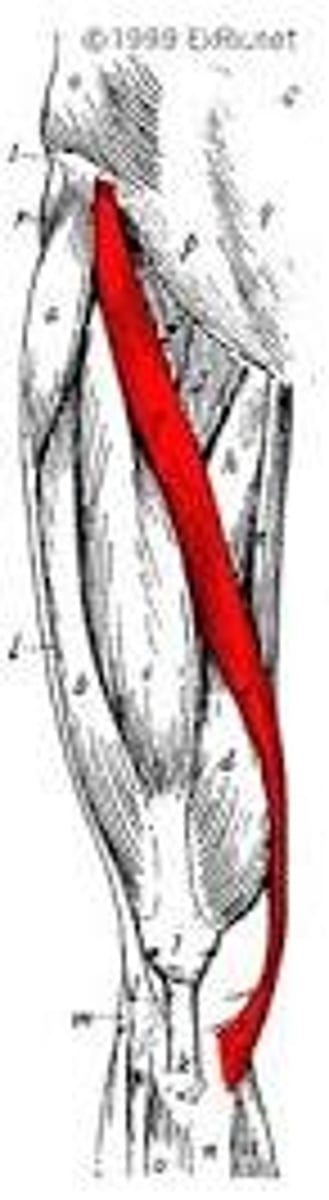 <p>Anterior superior iliac spine (ASIS)</p>