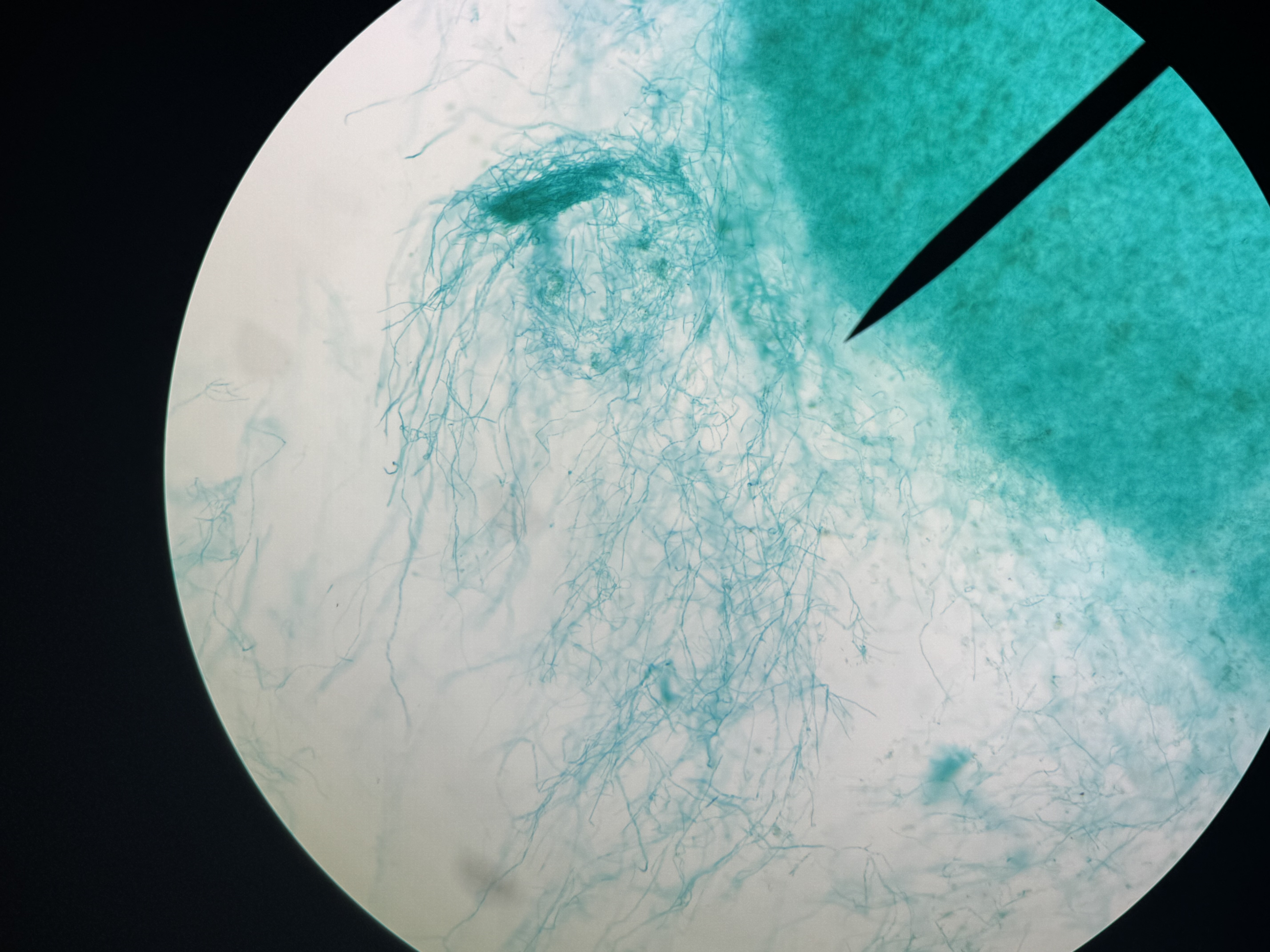 <p>Penicillium conidia</p>