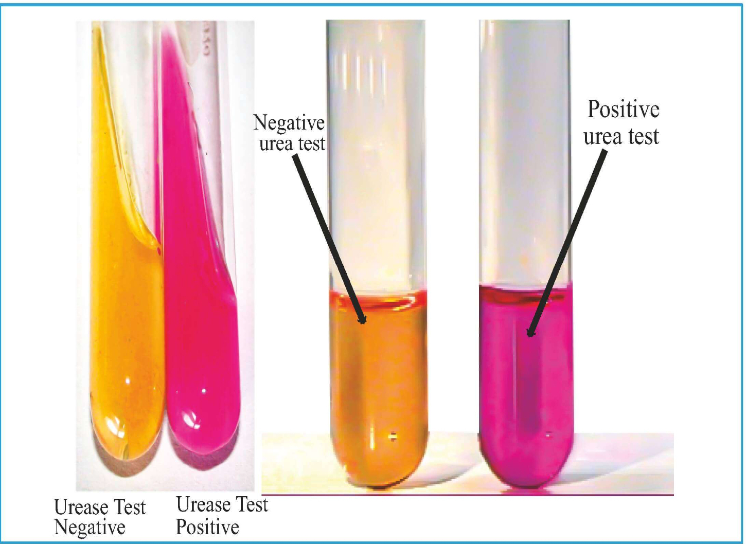 <p>• Proteus</p><p>• Ureaplasma</p><p>• Nocardia</p><p>• Cryptococcus</p><p>• Helicobacter</p><p>• Staphylococcus Saprophyticus</p><p>• Staphylococcus Epidermidis</p>