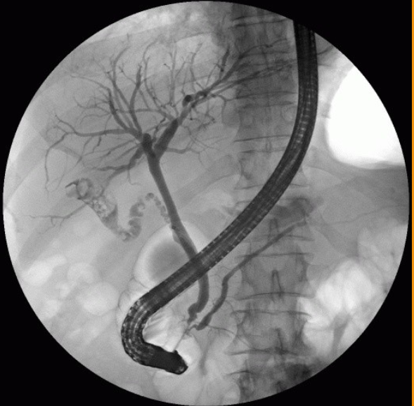 <p>1)procedure performed?</p><p>2)contrast media used?</p><p>3)How  contrast media administered?</p>