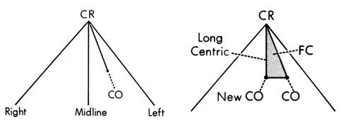 <ul><li><p>CR-CO should be down midline and be short</p><ul><li><p>If adjusted, long centric or freedom in centric may occur which is undesirable and may need orthodontic treatment</p></li></ul></li></ul><p></p>