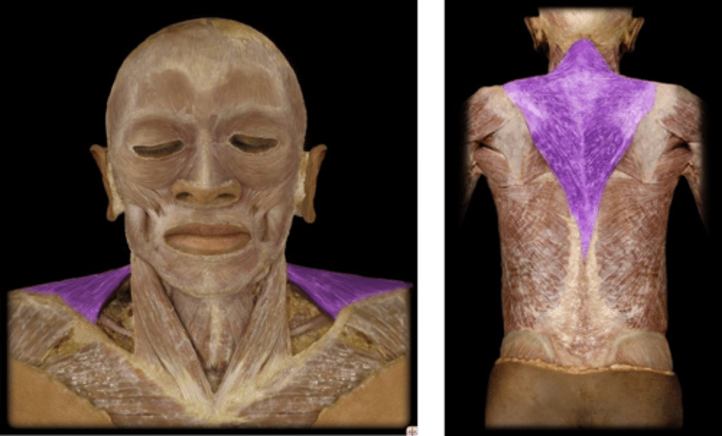 <p>What is the name of this muscle, highlighted in purple?</p>