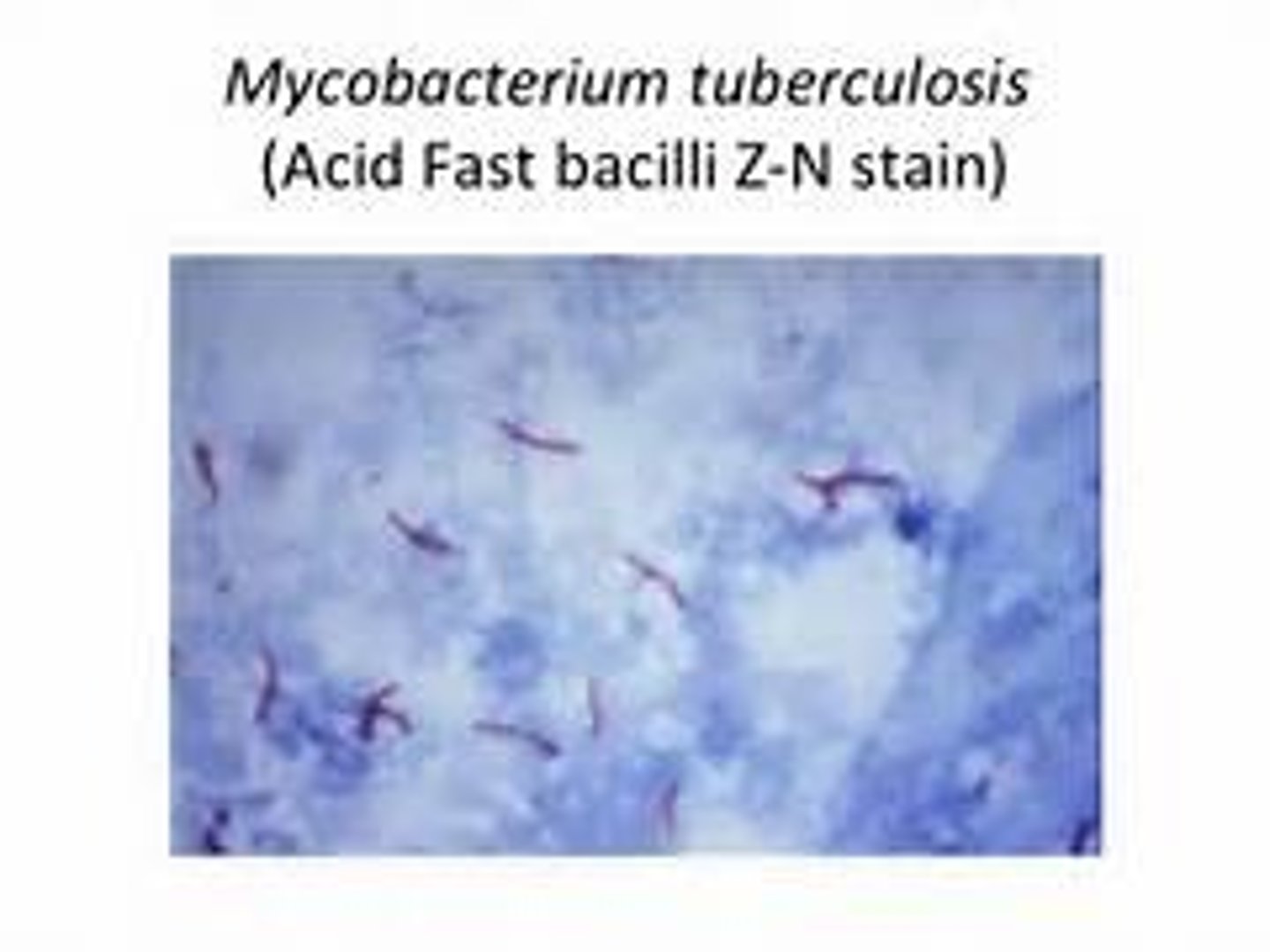 <p>Acid-fast bacilli</p><p>Causes granulomatous skin and respiratory disease</p><p>Zoonotic</p>