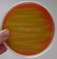 <p>what result on a BAP plate is this </p>