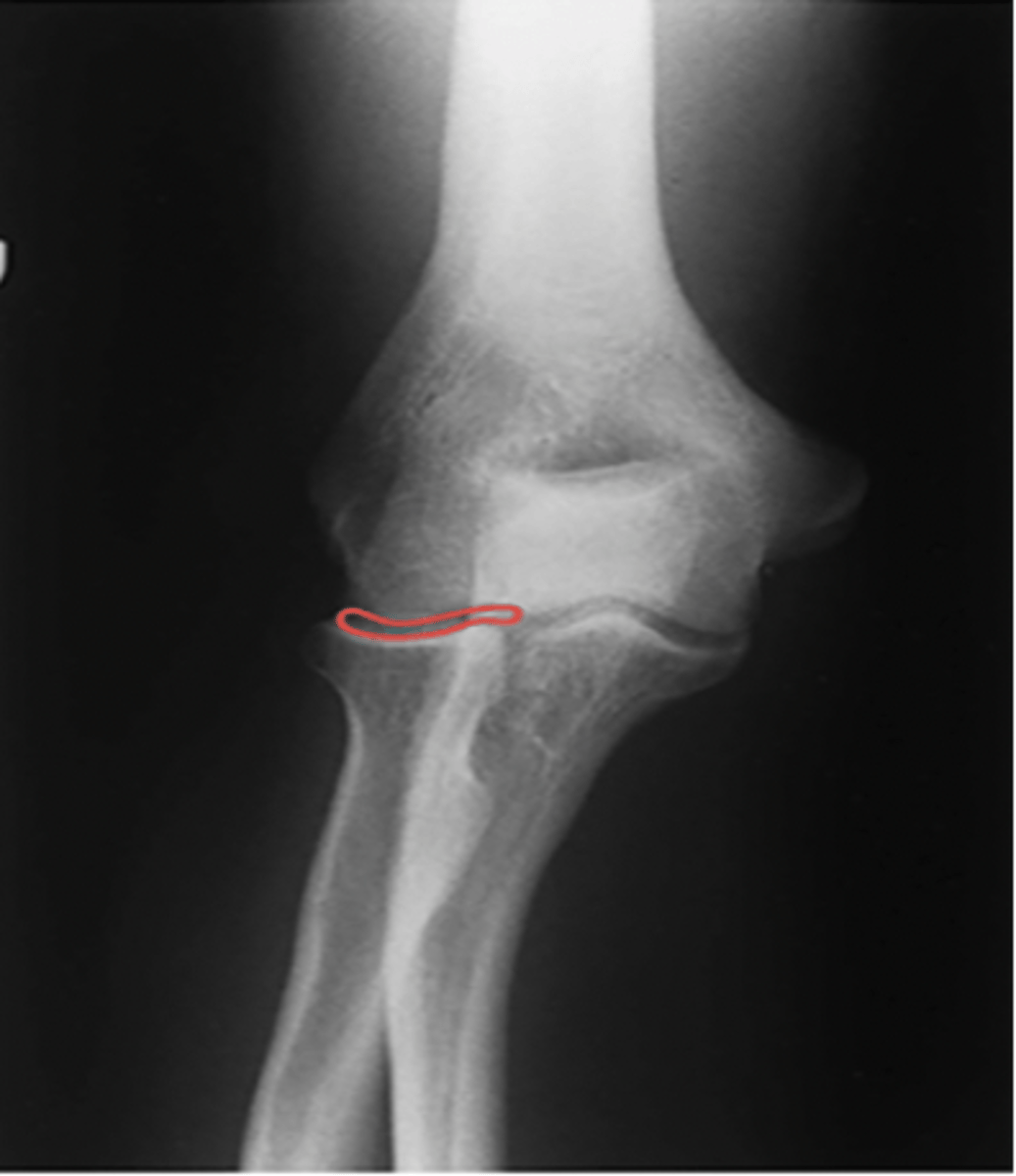 <p>What structure is highlighted?</p>